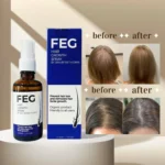 FEG Plus Hair Growth Spray Stimulate Follicles Reduce Hair Fall And Encourage Thicker Healthier Hair - 50ML - Image 3
