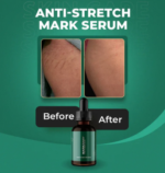 Markaway Advanced Stretch Mark Serum – Clinic-Tested Formula for Prevention & Fading | Retinol, Hydroquinone, & AHA/BHA-Free - Image 3