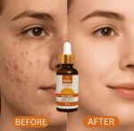 Relax Vitamin C Daily Serum - 30ml | Visibly Brightens, Evens Skin Tone, and Reduces Aging Signs for a Radiant, Youthful Glow - Image 2
