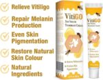 Fivfivgo™ VitiGO Bee Venom Correcting Cream (20g) – Advanced Melanocyte Support for Skin Pigmentation Recovery and Even Skin Tone - Image 2