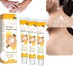 Bee Venom Vitiligo Treatment Cream - Restore Melanocytes & Skin Pigmentation - Natural Melanin Care Ointment for Leukoplakia (20g)