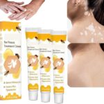Bee Venom Vitiligo Treatment Cream - Restore Melanocytes & Skin Pigmentation - Natural Melanin Care Ointment for Leukoplakia (20g)